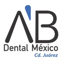Implantes dentales